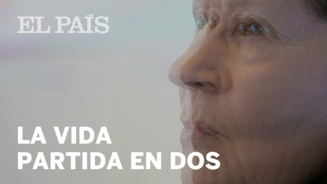 DGT alerta: &iexcl;Conducir despu&eacute;s de operaci&oacute;n de cataratas puede ser peligroso!